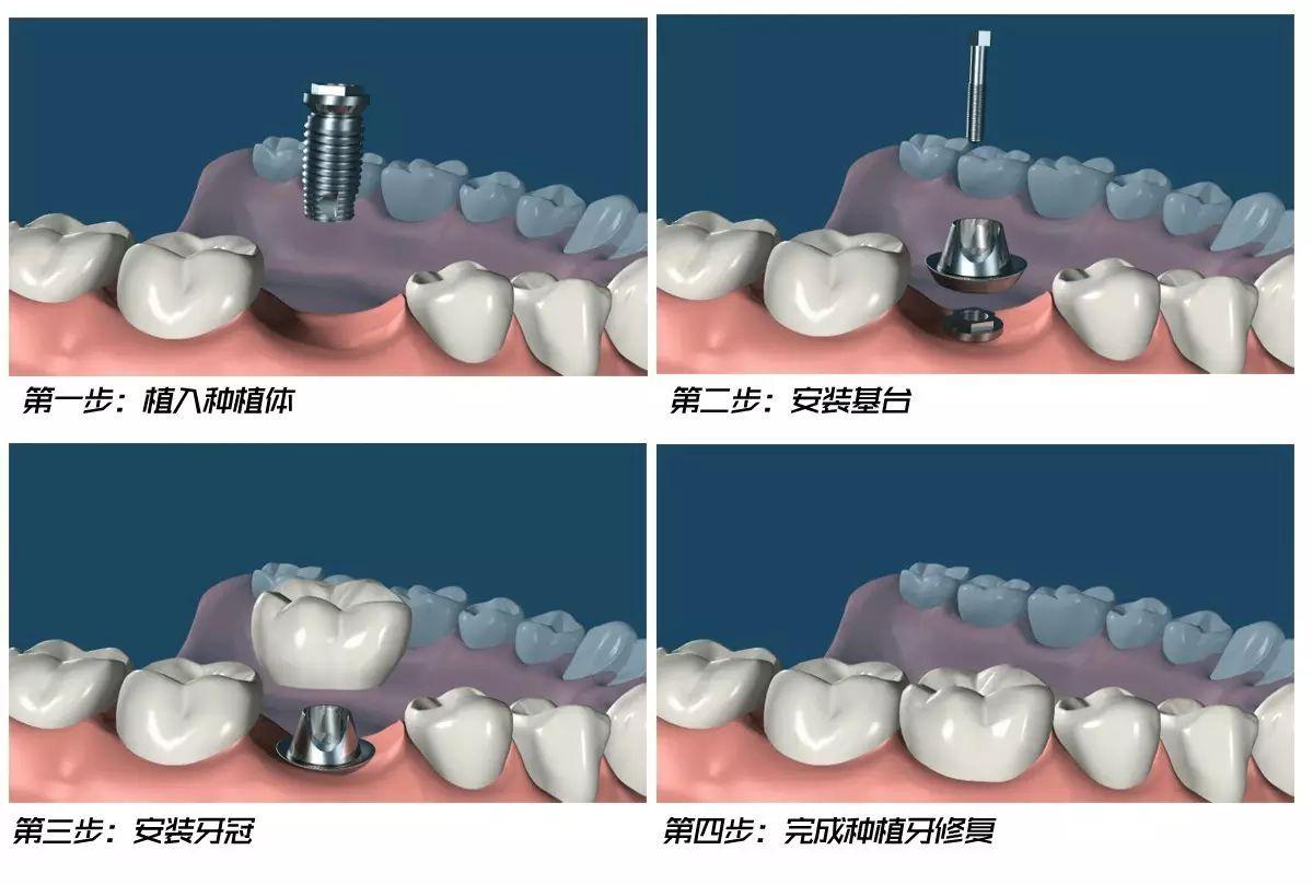 Z型鋼 第16頁(yè)